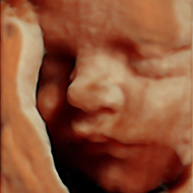 baby gezichtje